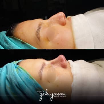 Slider image (6) Dr. Zeki Yasar Clinic